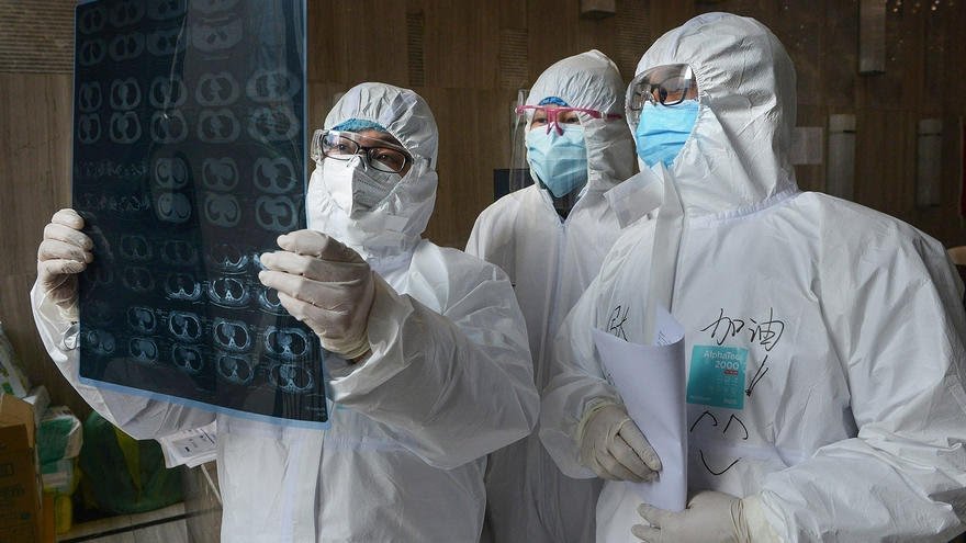 Le Covid19 s'attaque à tous les organes vitaux 1