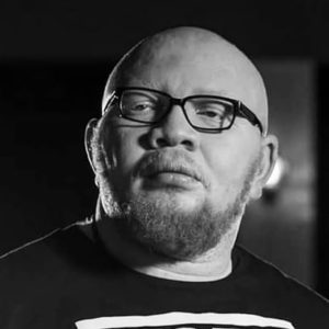 Yan Mambo, albinos et fier de l’être ! 1