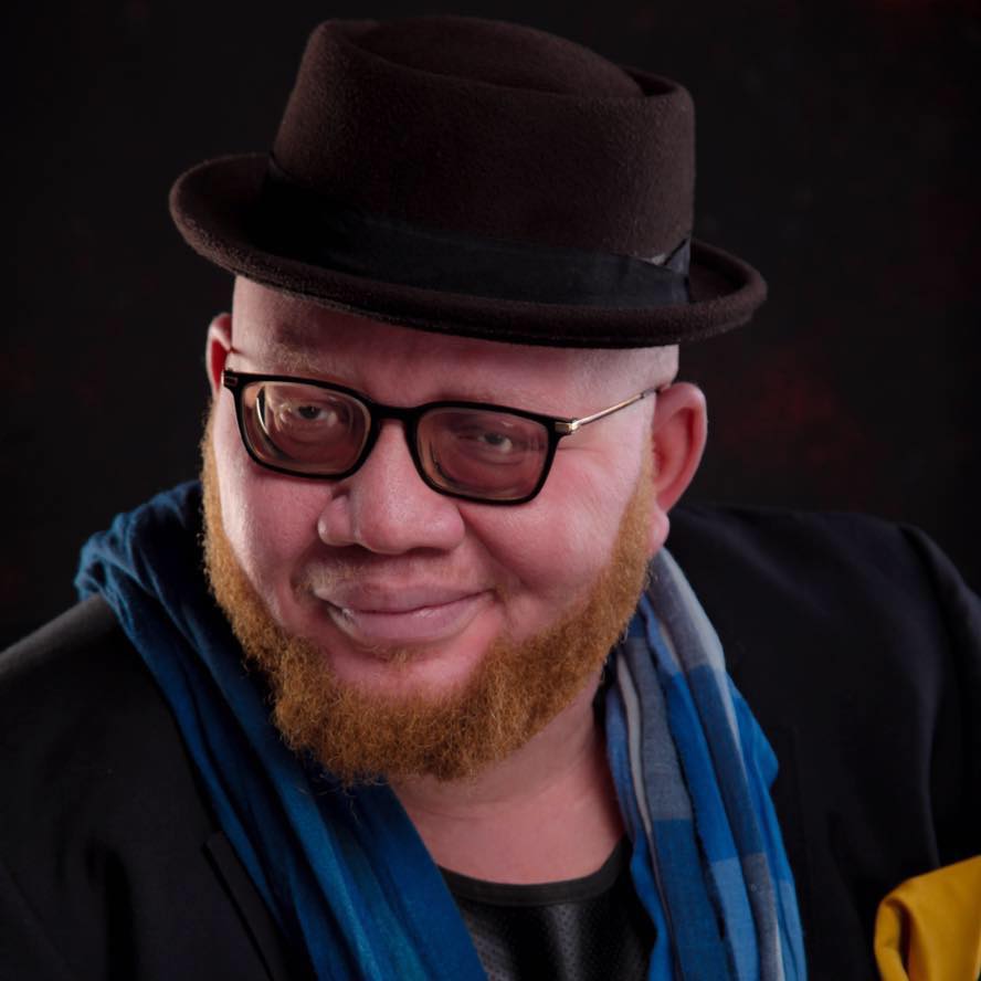 Yan Mambo, albinos et fier de l’être ! 3