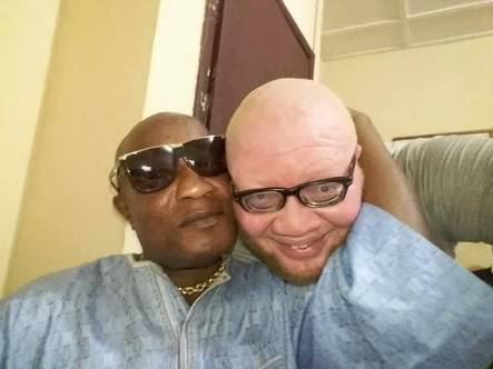 Yan Mambo, l'ours blanc : albinos et fier de l’être ! 1