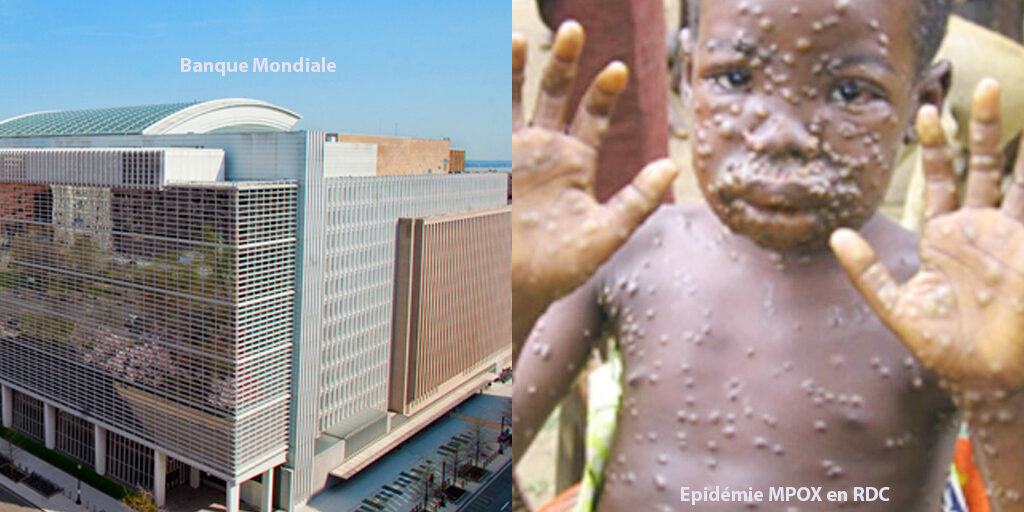 Banque Mondiale MPOX RDC